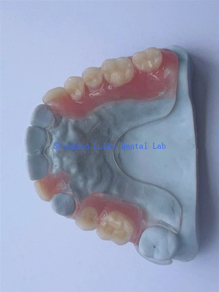 Imprimare 3D confortabilă cadru dentar dentar cu proteză acrilică