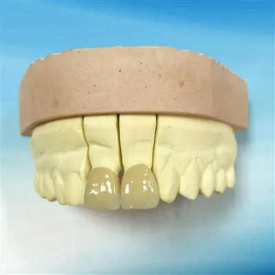 Estetic Dental All Ceramic IPS Emax Crown