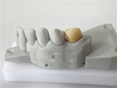 Fabrica de coroană de zirconiu dentar personalizat din China