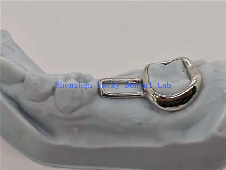 Space Retainer For Children